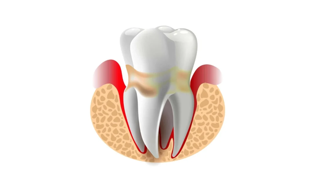 Periodontology