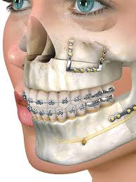 Oral & Maxillofacial Surgery